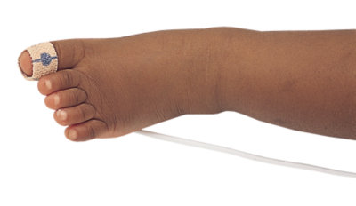 Nellcor™ Adhesive SpO₂ Sensor | Medtronic