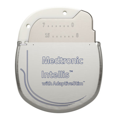 Intellis™ Neurostimulation System | Medtronic (CA)